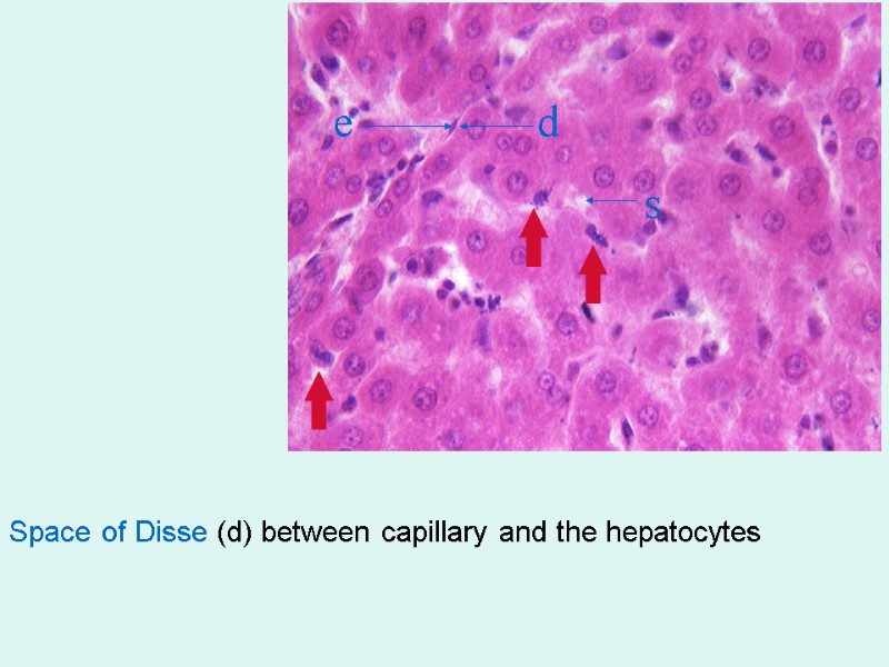 Space of Disse (d) between capillary and the hepatocytes e  d s